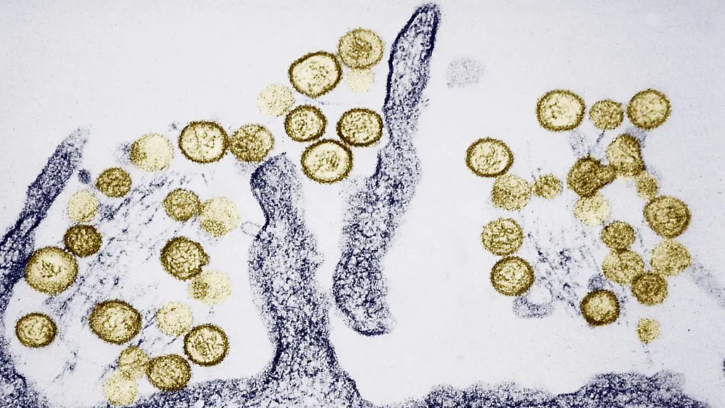 Transmission-electron-micrograph-of-the-Sin-Nombre-hanta-virus-Hantaviruses-that-cause-Hantavirus-pulmonary-syndrome-HPS-are-carried-in-rodent-droppings-especially-the-deer-mouse-Incubation-lasts-for-1-5wks-Sickness-begins-with-fever-and-muscle-aches-followed-by-shortness-of-breath-and-coughing