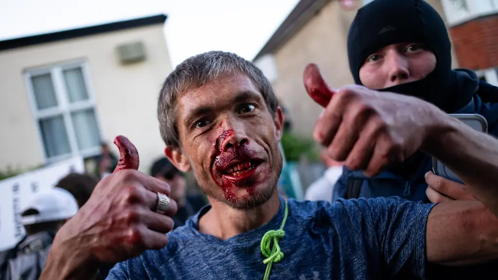 June-2-2026-Southampton-United-Kingdom-EDITORS-NOTE-Image-contains-graphic-content-A-man-is-seen-with-a-bloodied-face-as-violent-clashes-erupt-as-protesters-gather-to-express-their-anger-at-the-murder-of-Henry-Nowak-following-the-release-of-police-bodycam-footage-which-shows-Nowak-handcuffed-and-arrested-whilst-telling-police-he-had-been-stabbed-and-couldnat-breathe-Vickrum-Digwa-was-jailed-for-Nowak-s-murder-and-was-sentenced-to-life-in-prison-Digwa-had-lied-to-police-at-the-scene-stating-he-had-been-the-victim-of-a-racist-attack