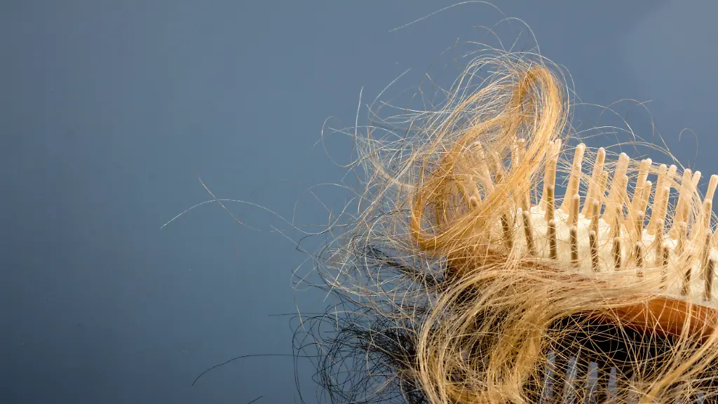 Studie mit Diabetes-Betroffenen: Abnehm-Medikamente könnten zu Haarausfall führen