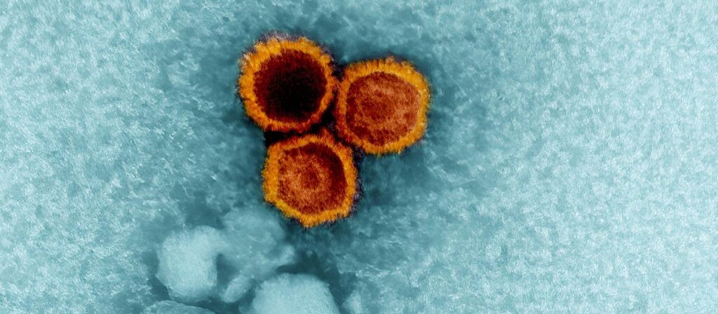 Studie: Wie ein Virus Multiple Sklerose mitauslösen kann