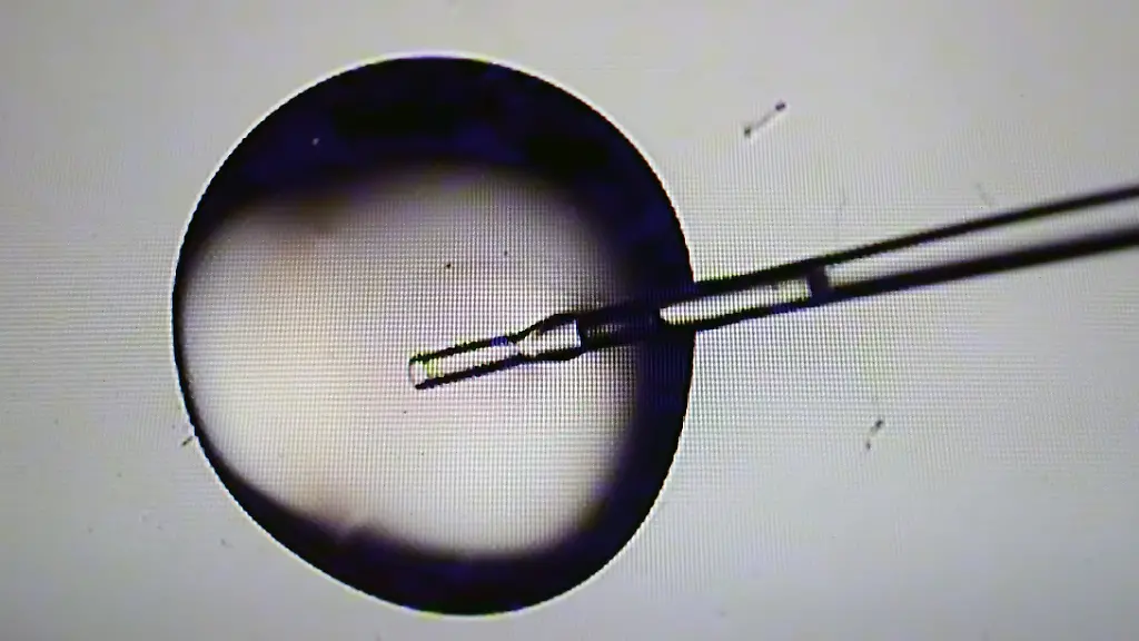 Frau in Italien wird fremder Embryo implantiert
