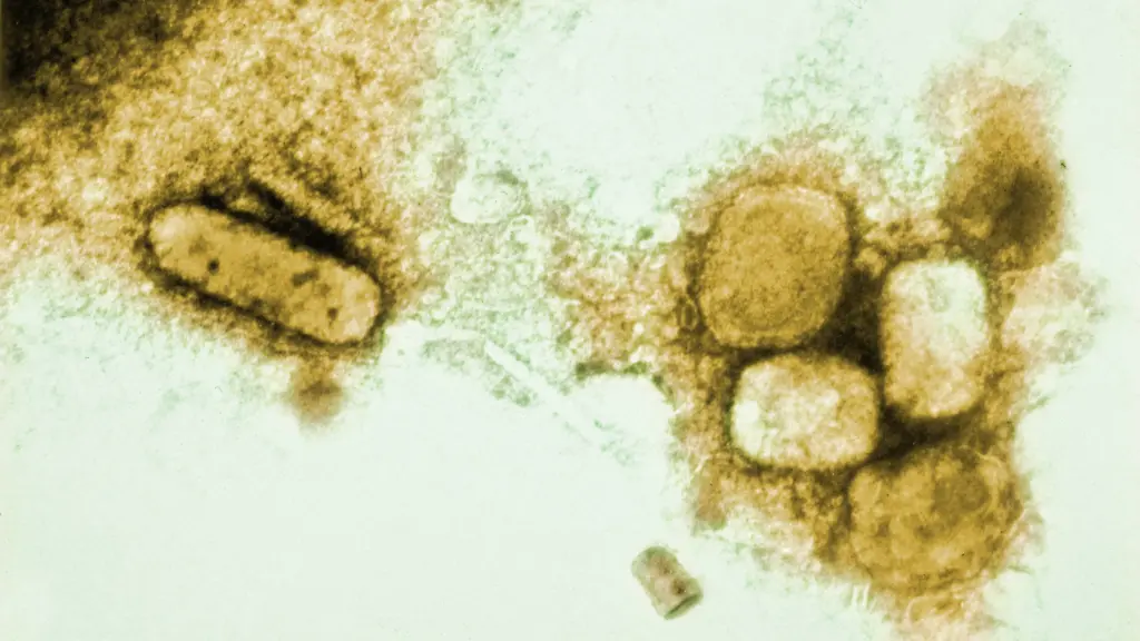 Ein Virus, Millionen Tote: Europäer brachten Pocken nach Amerika