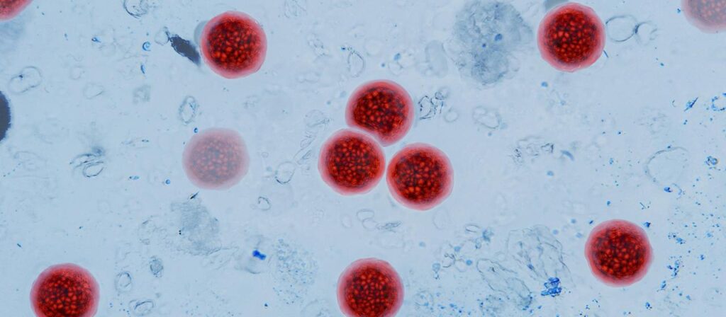 Cyclospora-Parasit: Mehr als 10.000 Durchfall-Fälle in den USA bestätigt
