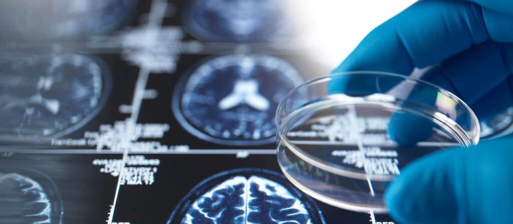3D-Hirngewebemodell soll Alzheimer-Forschung verbessern | tagesschau.de