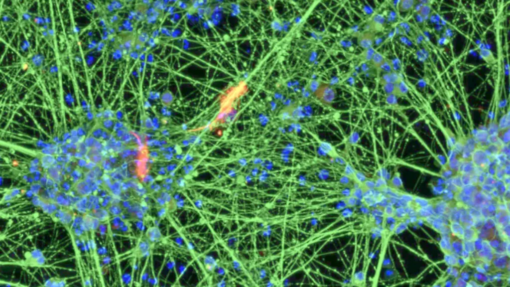 Anti-Aging im Labor: Bonner Forscher lassen alte Zellen wieder jung werden