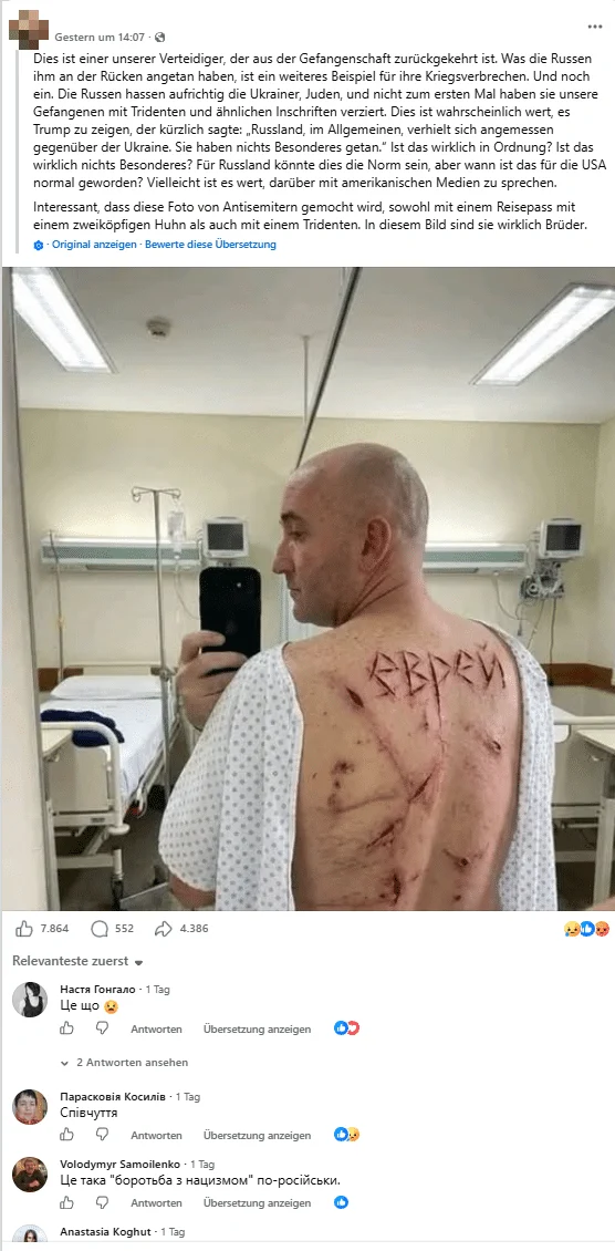 Anonymisierter Facebook-Beitrag mit dem angeblichen Bild eines gefolterten ukrainischen Soldaten