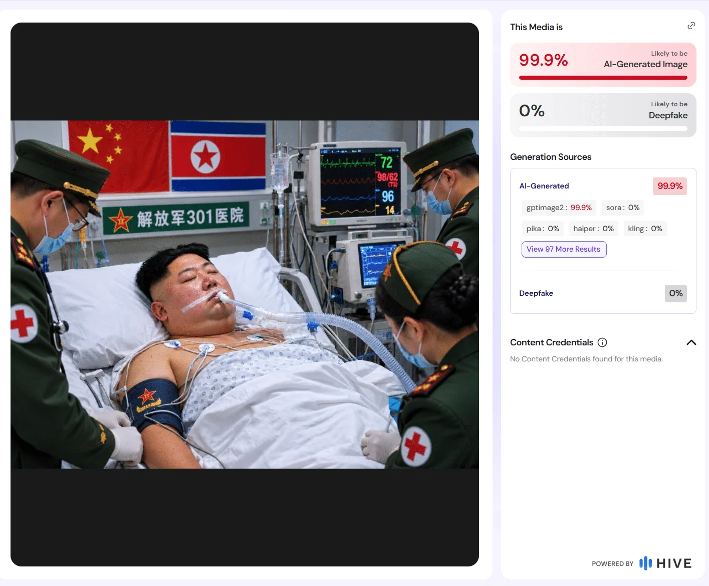 Hive-Auswertung des Krankenbettbildes mit 99,9 Prozent für AI-Generated Image und der Modellzuordnung gptimage2.